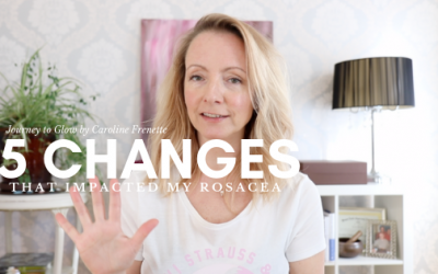 5 Big Changes I Made To Heal Rosacea Naturally & Holistically ⁣