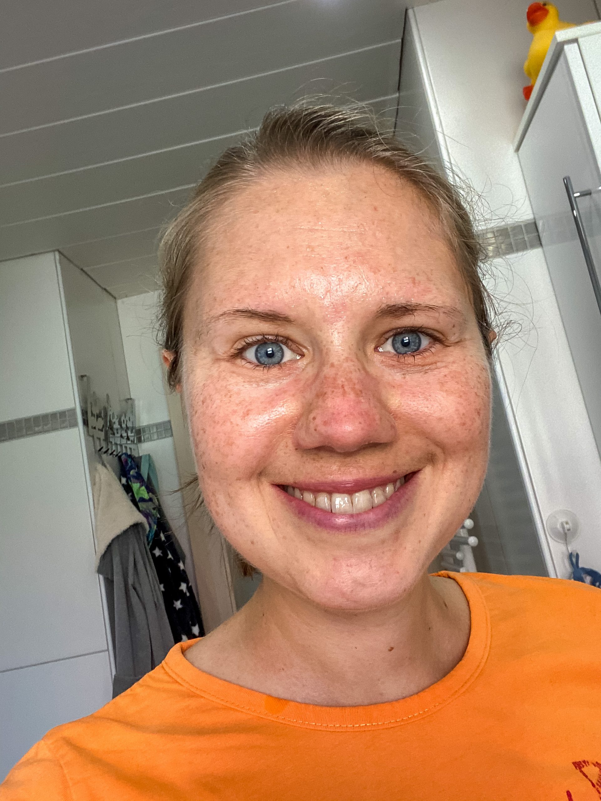 JTG 56 Natural Cure Rosacea, The Medical Medium “Protocol” & Celery